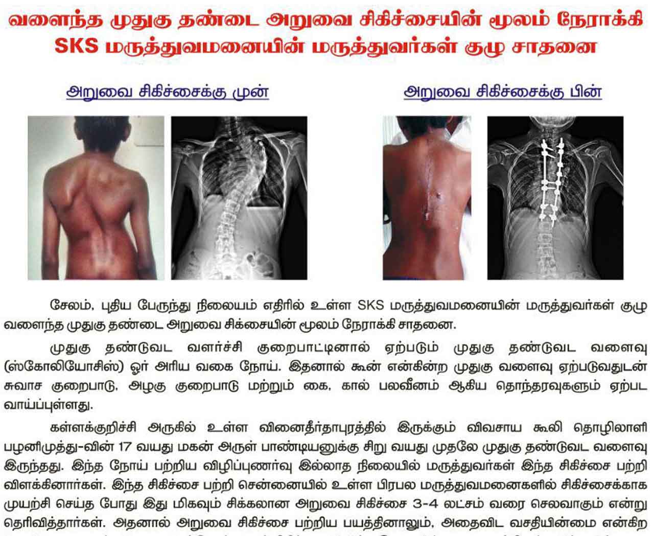 spine-surgery-salem-dr-vishnu-prasath
